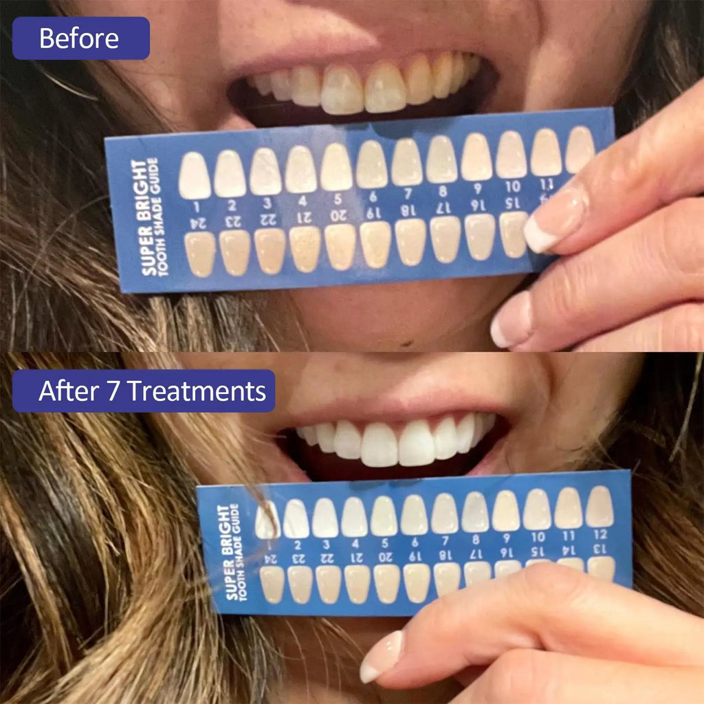 Teeth Whitening Kit with LED Light, 10 Min Fast Teeth Whitener with 3 Professional Teeth Whitening Gel, Safe Enamel and Non-Sens